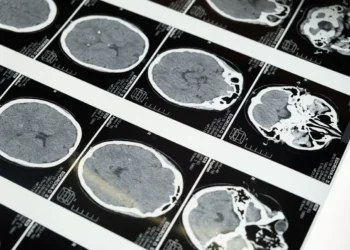Veterinarian reviewing a brain MRI scan of a small breed puppy, highlighting reduced cerebral volume
