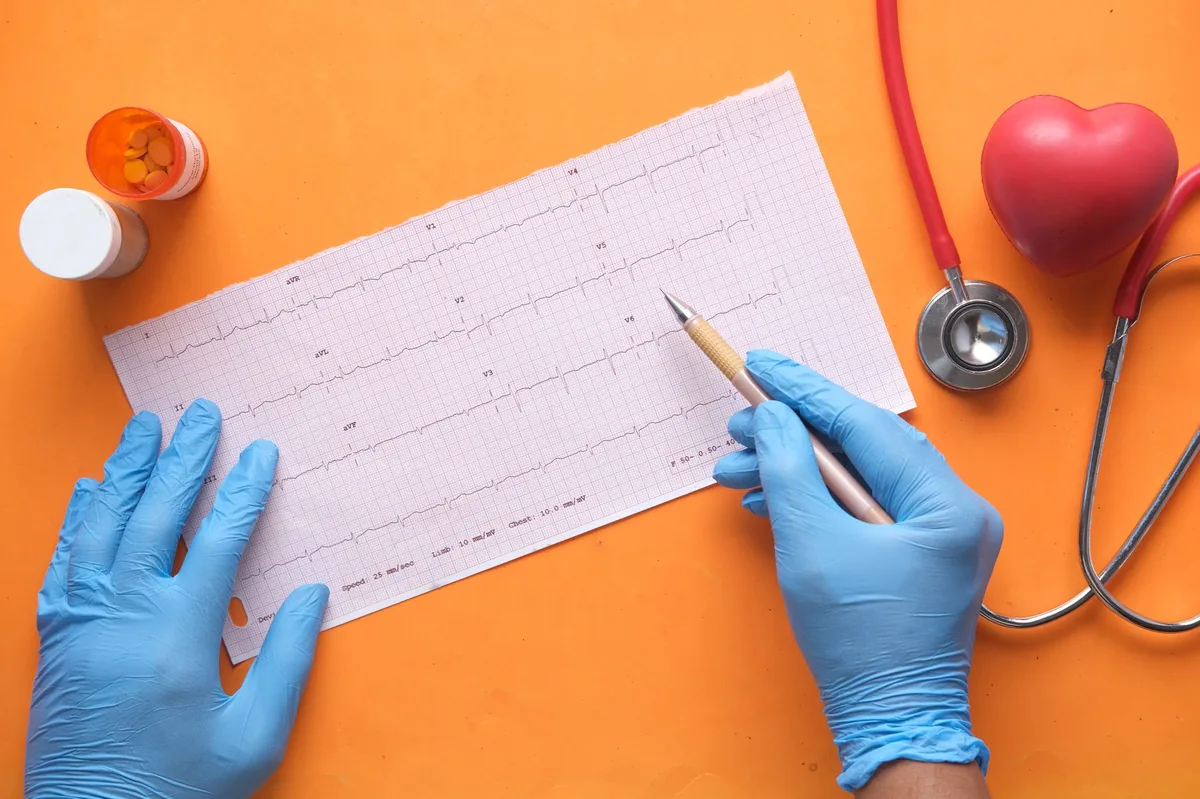 Close‑up of a dog’s chest showing a vet listening with a stethoscope, indicating irregular heartbeat detection