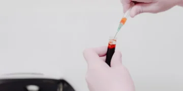Veterinarian gently examining a golden retriever’s gums with a stethoscope, showing pale pink gums indicating possible alkalosis