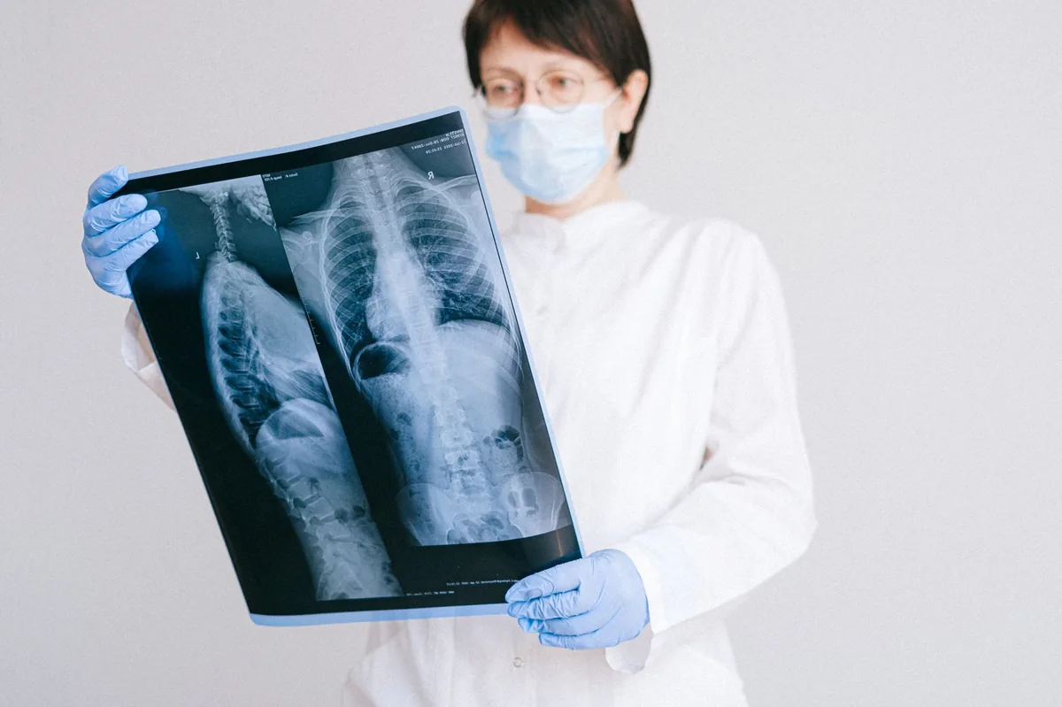 Veterinarian examining a dog's lungs on an X‑ray monitor, calm clinic environment